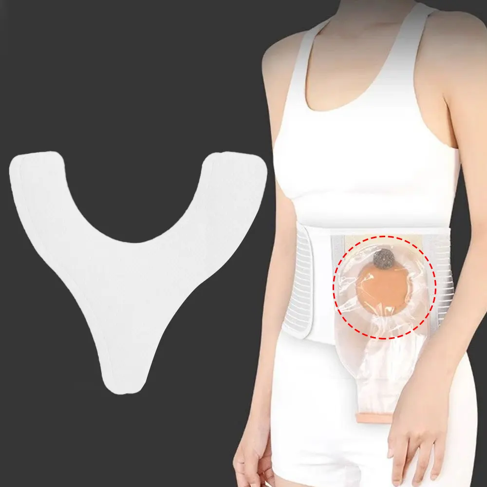 20-200Pcs Ostomy Barrier Strips Y Shape Adhesive Seal Extender Strip For Colostomy Bags Ileostomy Tape For Stoma Ostomy Bag