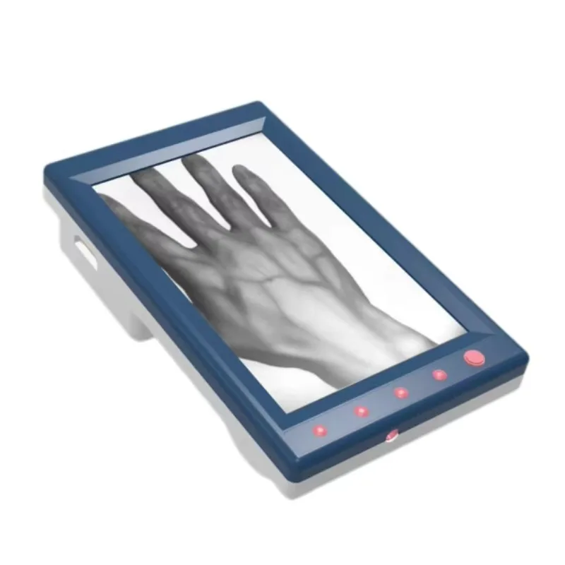 MC401 Portable Vein Finder — LCD Display Handheld Vein Locator for Hands, Legs, Feet & Forehead