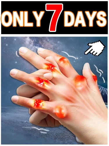 Promociones navideñas, ayuda a las personas con problemas de movilidad, resuelve sus problemas.