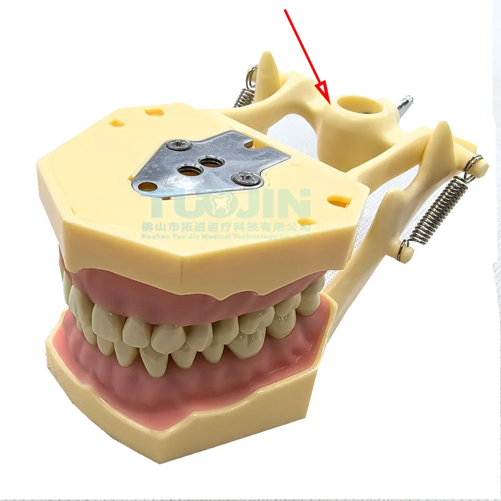 Dental Typodont Standard Practice Filling 28Pcs 32Pcs Screw-in Teeth Model Implant Restoration Demo only fit fracaso