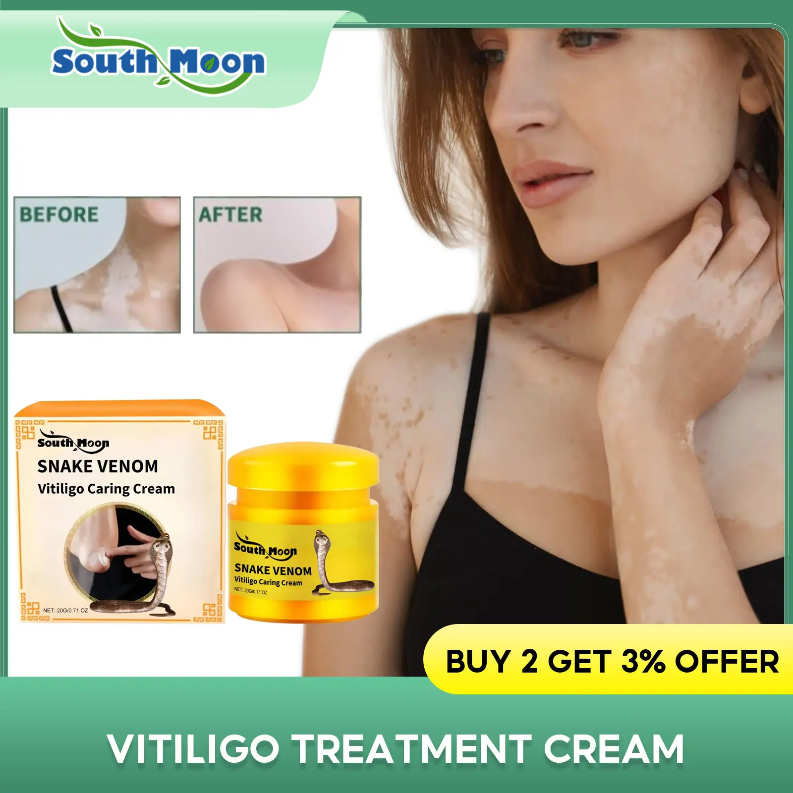 

Vitiligo Treatment Cream Remove White Spots Freckle Reduce Pigmentation Repair Dark Spot Whitening Brighten Skin Care Products