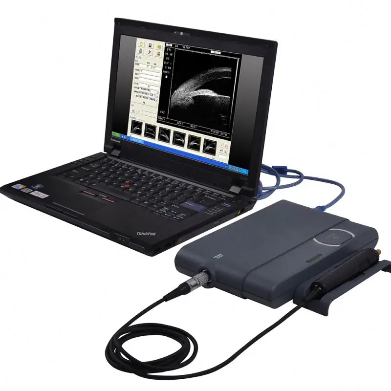 Ophthalmic Ultrasound Ecografo Ocular Ubm Ophthalmic Ultrasound Biomicroscope For Ophthalmology