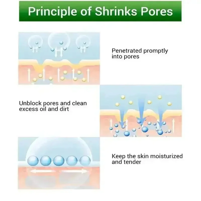 حمض الساليسيليك كريم تكرير المسام تقليص المسام Lmprove تبييض مكافحة الشيخوخة كريم الوجه حب الشباب كريم 20 جرام العناية بالبشرة #4