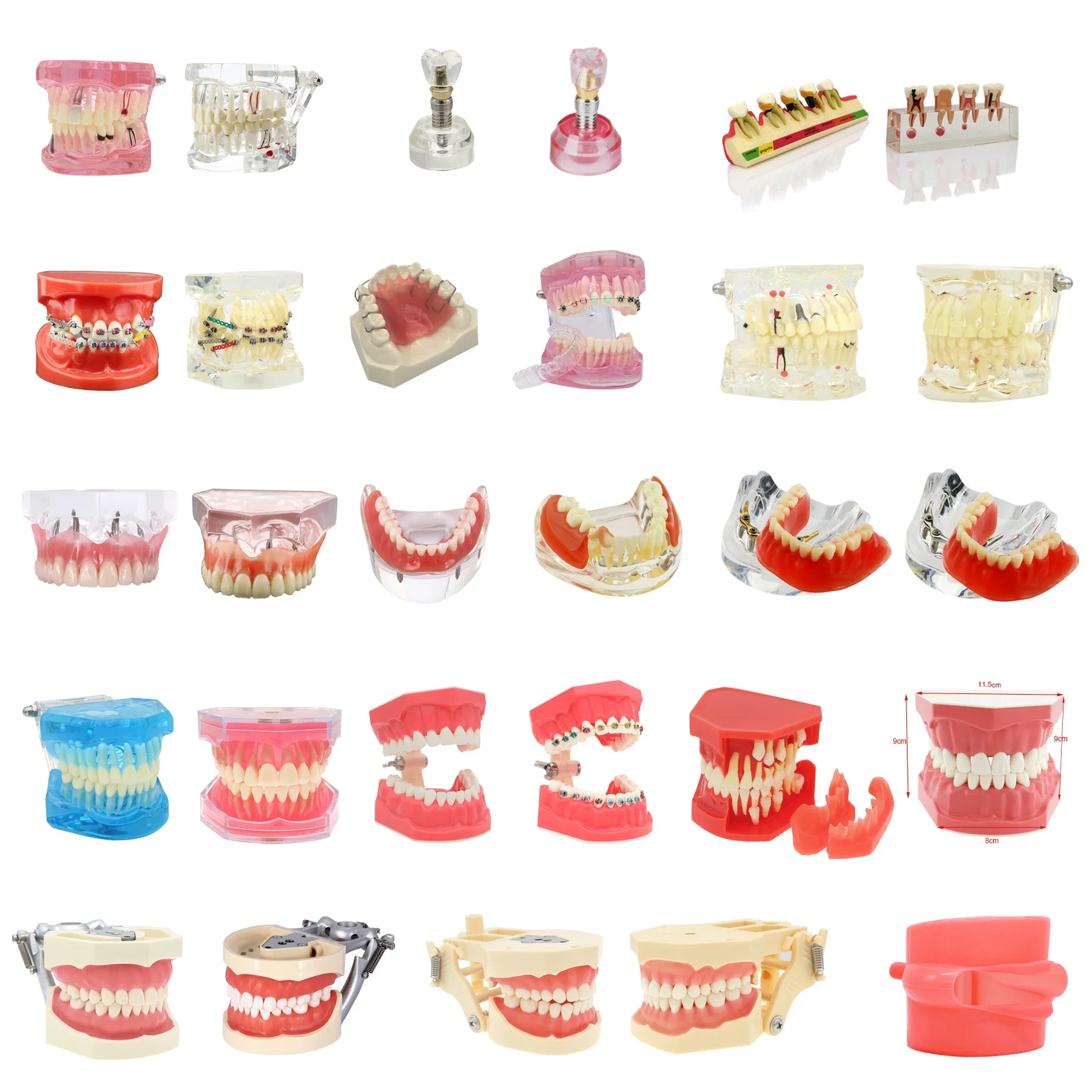 Dental Model Teeth Implant Orthodontic Periodontitis Standard Model Dental Teaching Display a variety of dental diseases Model