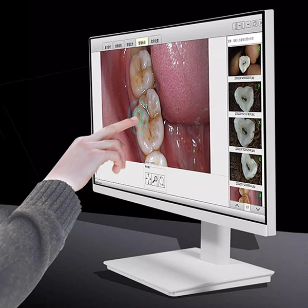 china usb 24 Inch Touch Screen   all in one intraoral  with