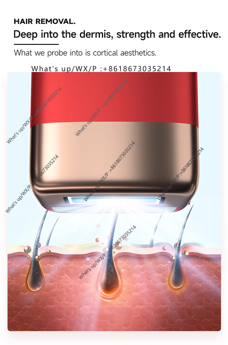 Dispositivo de depilación 500000Fast con reemplazo