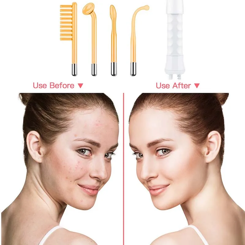 Профессиональный ручной косметический аппарат, высокочастотная палочка для лица, 4, различные стеклянные трубки, палочка для озоновой терапии, инструмент для красоты