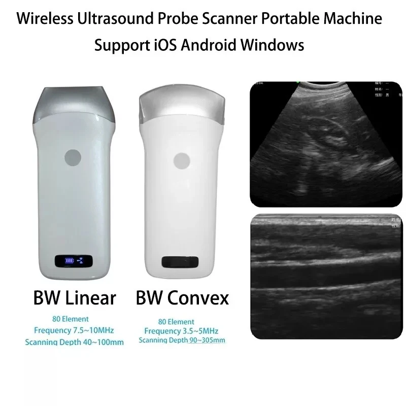 Wireless Ultrasound Probe Scanner Portable Machine Support iOS Android Windows