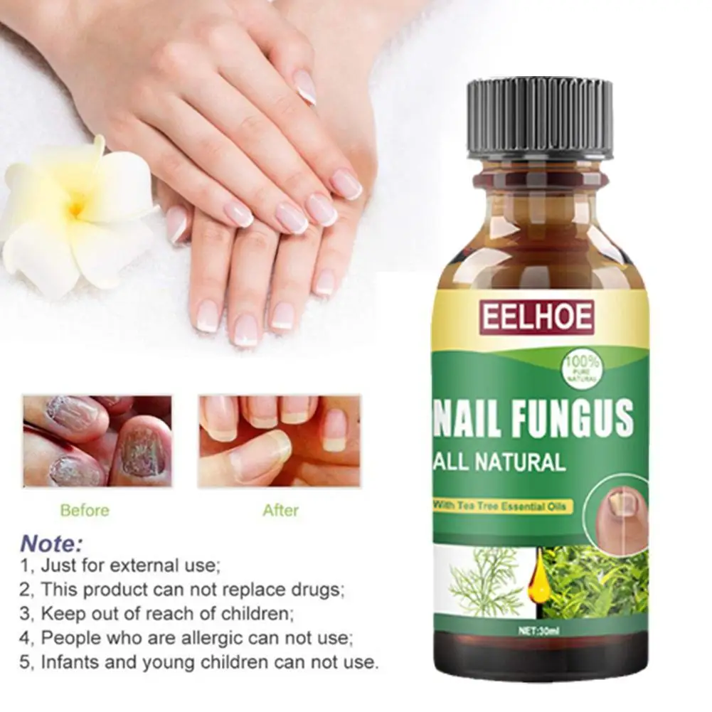 Unha Fungal Tratamento Cuidados Essence, Clareamento do pé, fungo, Paroníquia Infecção, Remoção Unhas Gel, Anti Onicomicose, K7O7