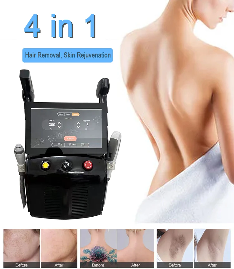 4in1 4000w Soprano Titanium Ice Platinum Diode 755 808 1064nm 4 Wavelength Laser ND:YAG Machine Painless Hair Removal Machine