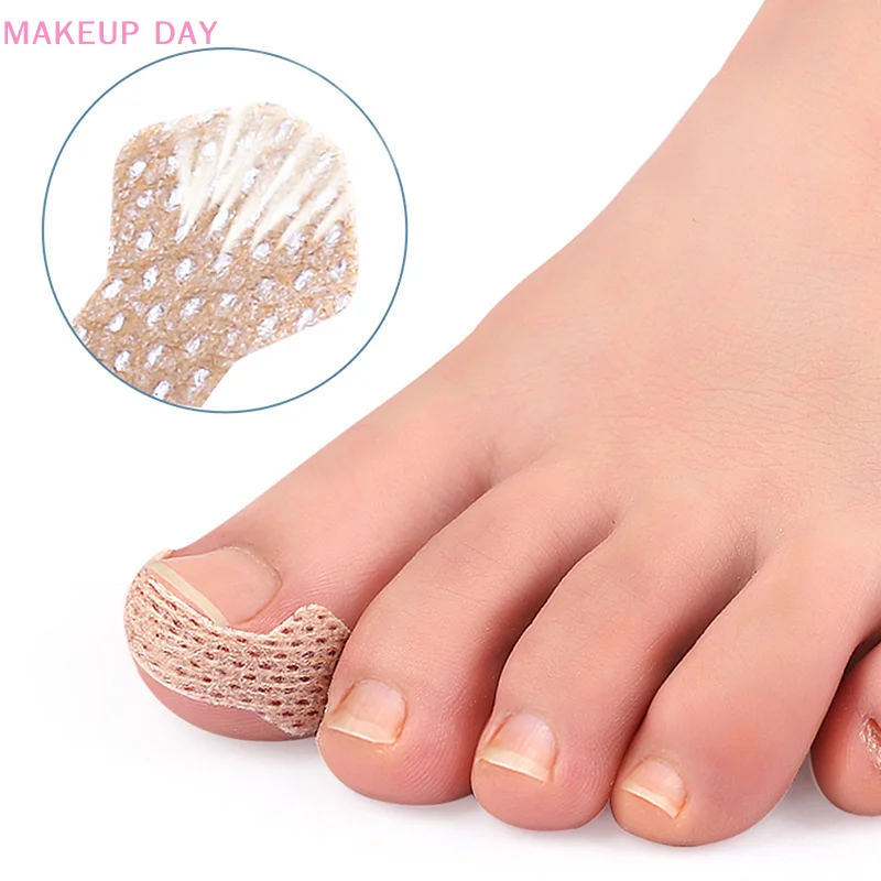 4/10 fogli Pedicure strumento per unghie incarnite adesivi per unghie dei piedi per correttore per unghie fissatore per trattamento paronichia recuperare Bunion