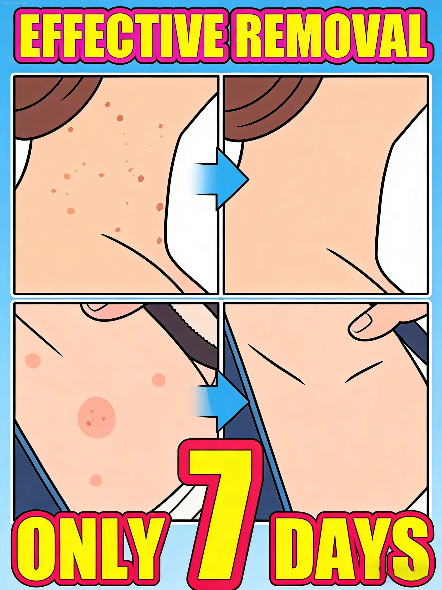 Professional and sᴀғᴇ ʟᴀsᴇʀ ᴛʀᴇᴀᴛᴍᴇɴᴛ allows for natural removal of the skin, painless and without leaving any