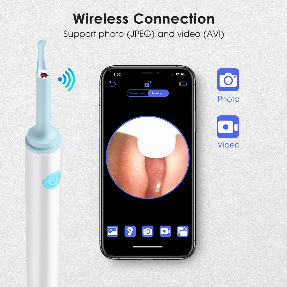 5MP WIFI Elettrico Digitale Otoscopio Detergente per cerume Endoscopio Wireless Visual Ear Picker Strumento per la rimozione del cerume per Iphone Android