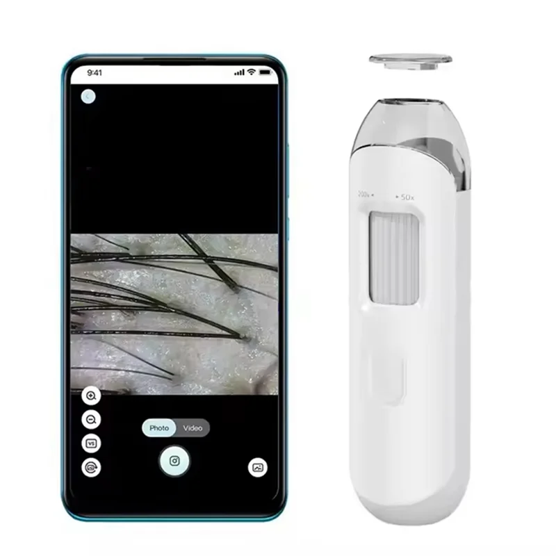 Professional Skin Health Analyzer Electron Dermatoscope - Digital Scalp Camera And Pore Magnifier Tool