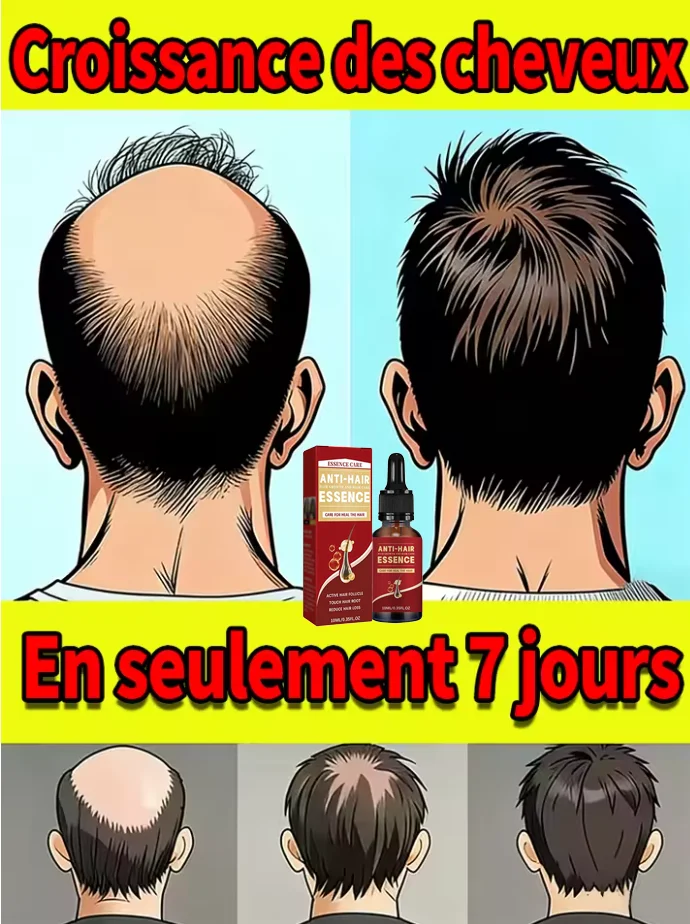 

Generation-2,M-shaped,to solve hair problems and protect your scalp health,care tool