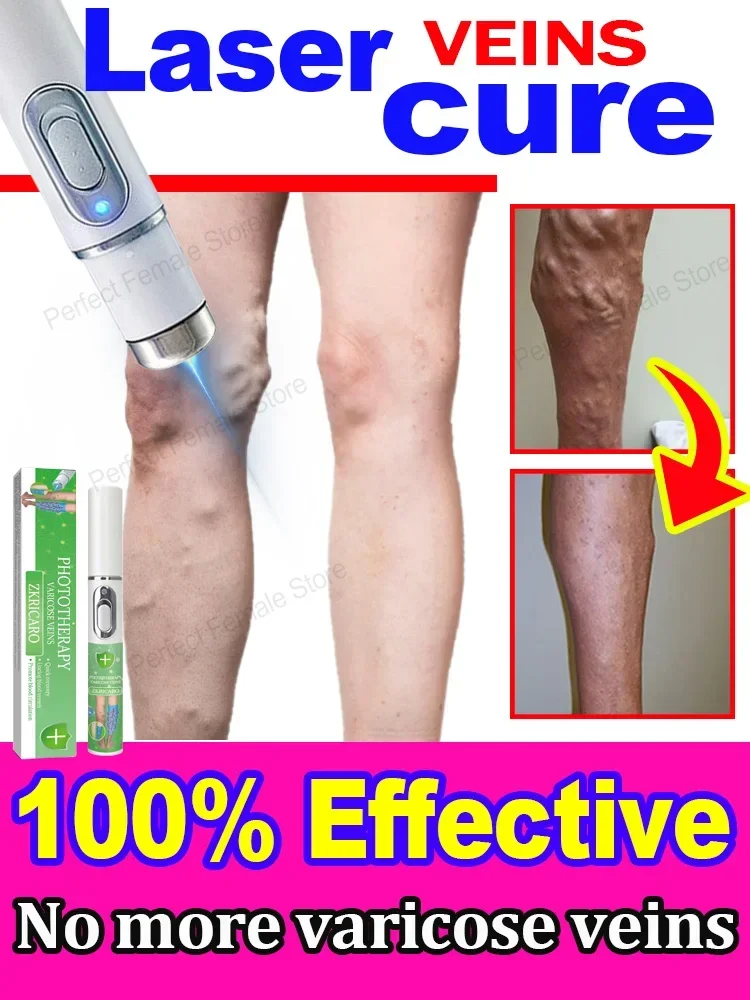 vein laser product