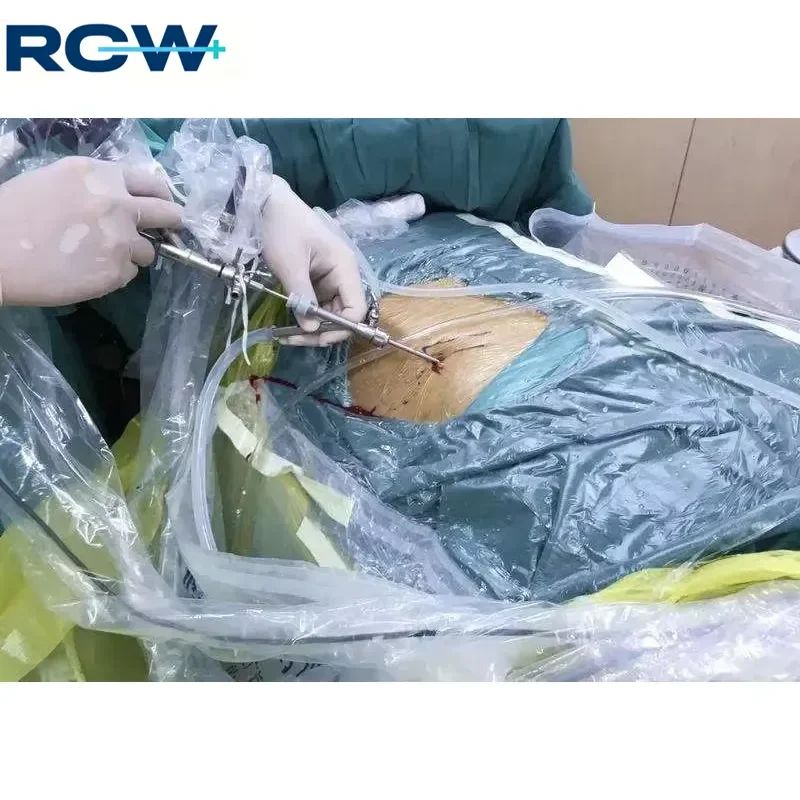 RCW JS-1W (19Fr)Transcutaneous Nephroscope Instruments Urology