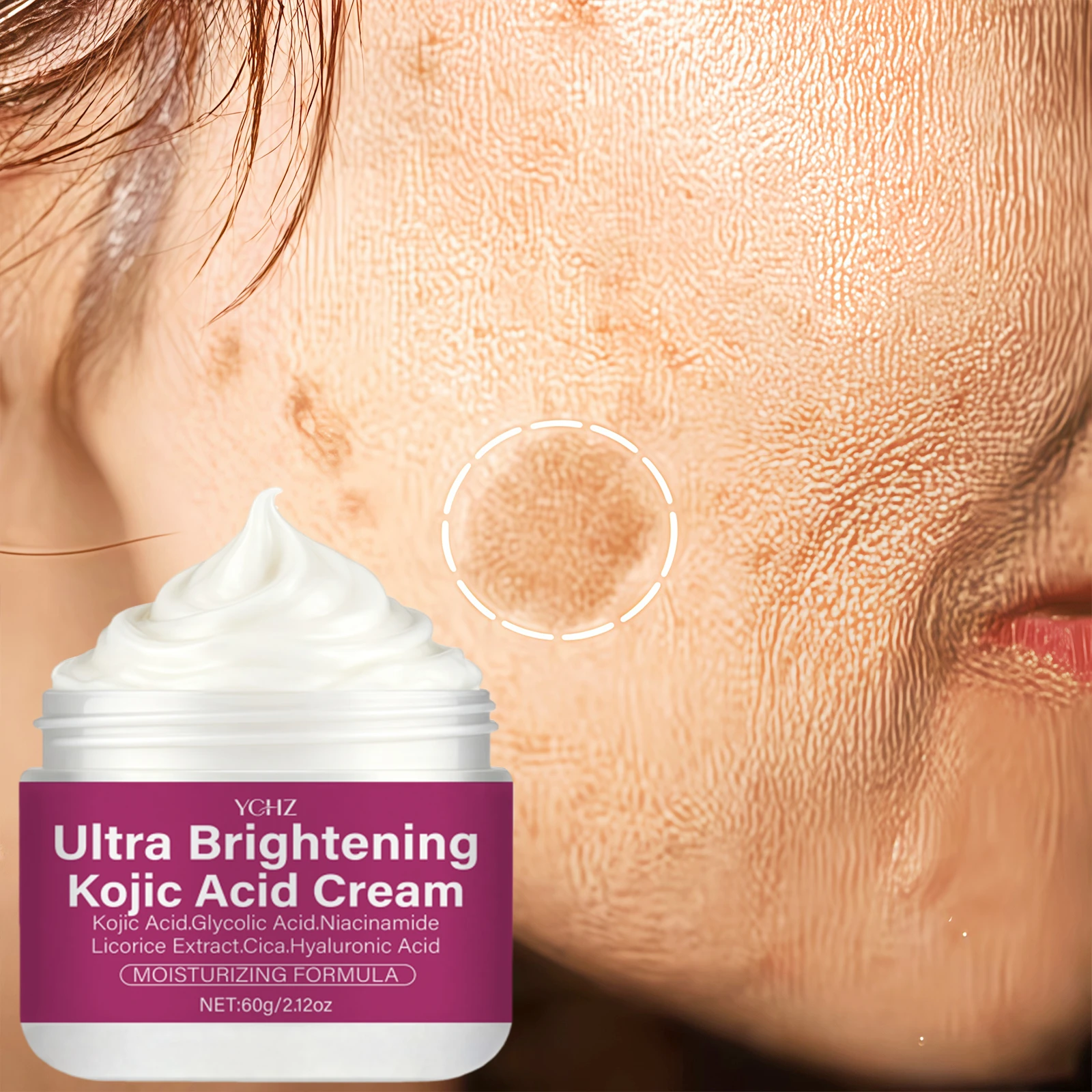 Kojic Acid Brightening Cream Contains Niacinamide, Vitamins C and E, and Hyaluronic Acid, Which Can Even Out Skin Tone, Hydrate and Moisturize, Suitable for Both Men and Women, and for All Skin Types
