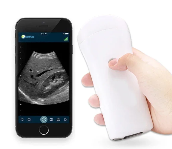 

Portable Mini USG Wifi Smartphone Wireless Ultrasound Probe For Android, IOS,Windows