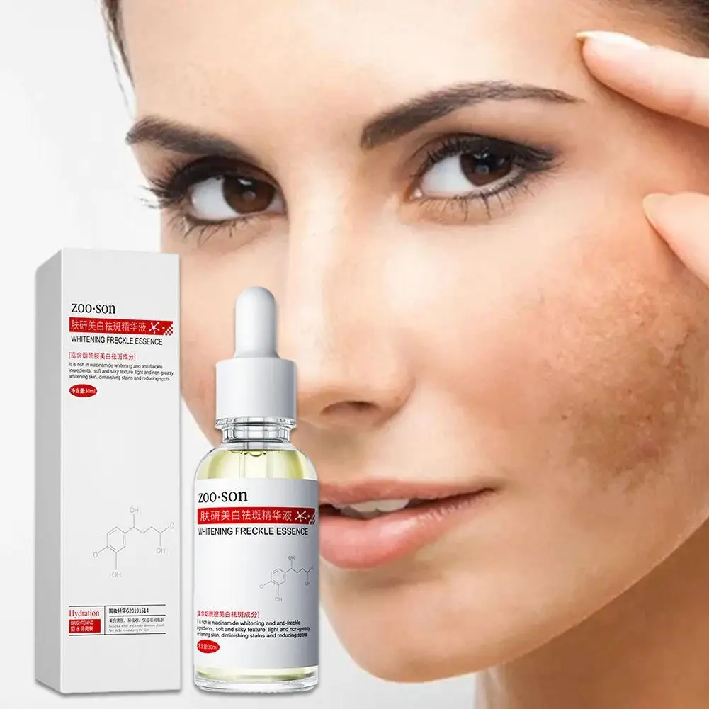 Suero blanqueador para pecas, esencia para eliminar manchas oscuras, niacinamida antienvejecimiento, pigmentación, Melasma, ilumina el cuidado de la piel