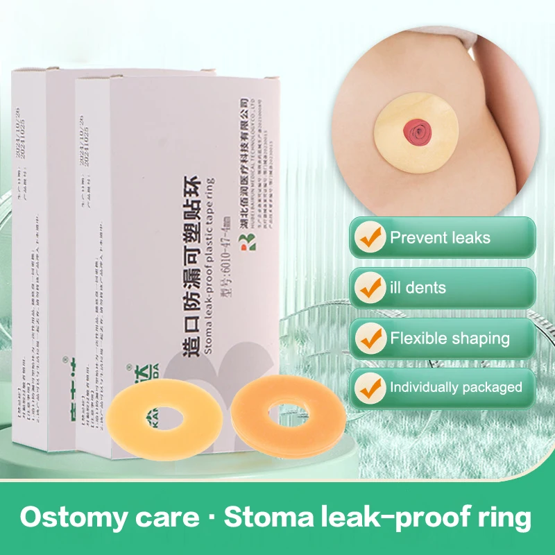 10Pc Anti-Leakage Ring For Colostomy Bag Ostomy Paste Ring Baseplates Stoma Care Products To Protect Skin