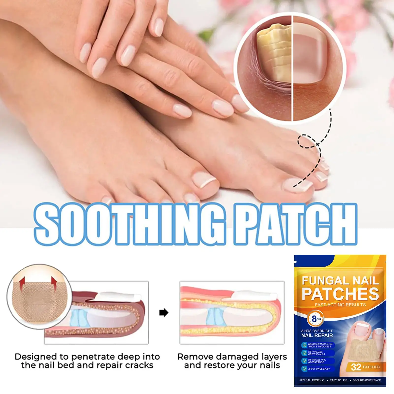 32개 네일 리페어 패치 발톱 재생 교정 스티커 손발톱 주위염 회복 페디큐어 도구 갈라진 손톱 보호 테이프