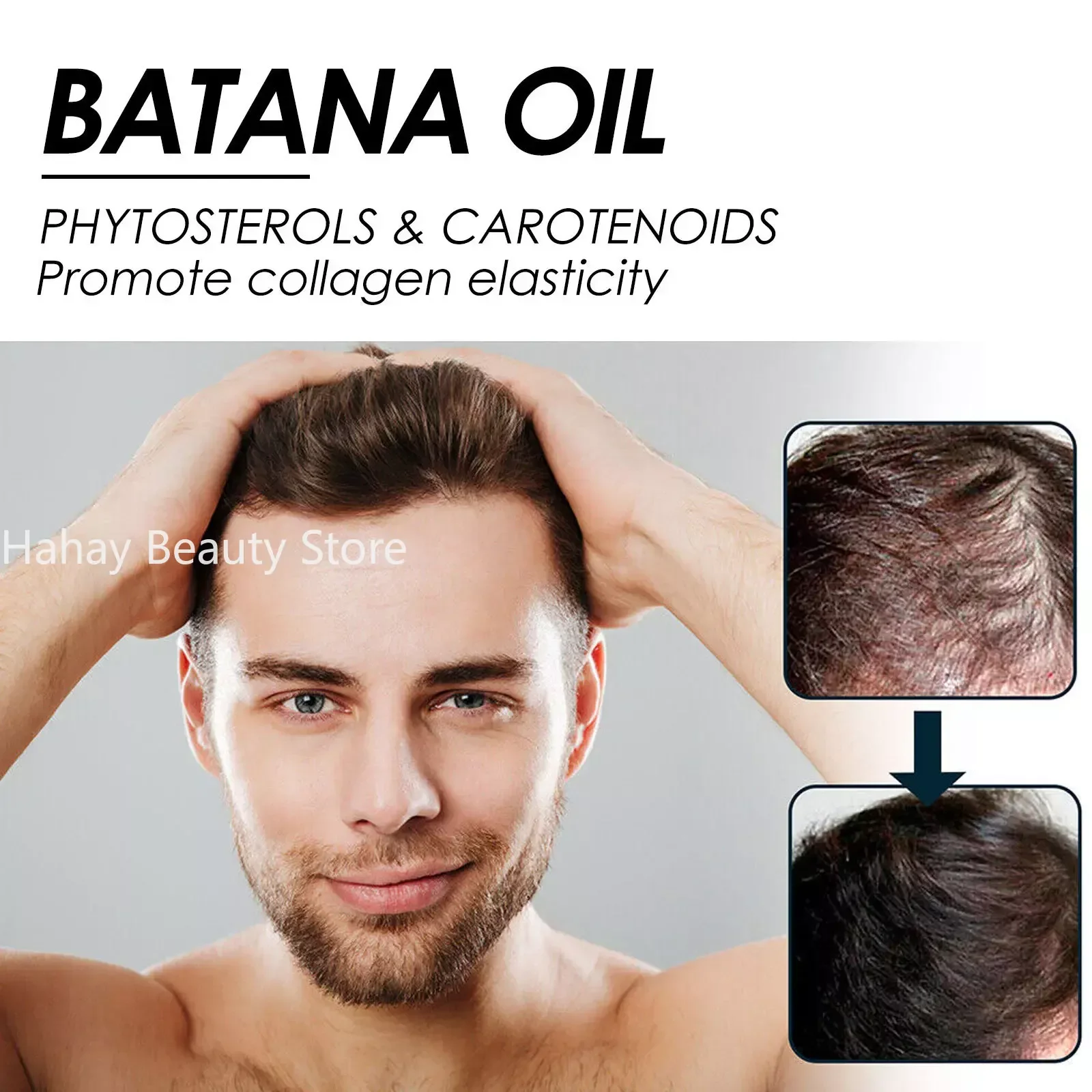 African Batana Oil Hair Growth Spray Repair Baldness Hereditary Hair Loss Treatment moisturize the scalp aceite para el cabello