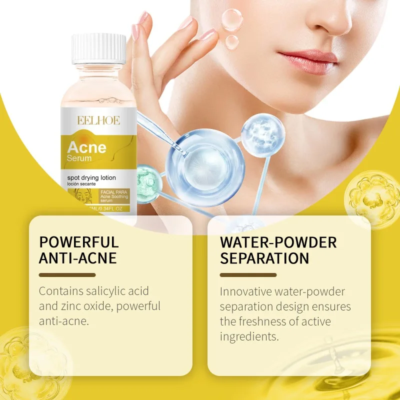 Acne Gezicht Serum Puistje Scaring Marks Zacht Verwijderen Olie Controle Gevoelige Huid Hydraterende Helderder Gezichtsserum Zachte Huidverzorging