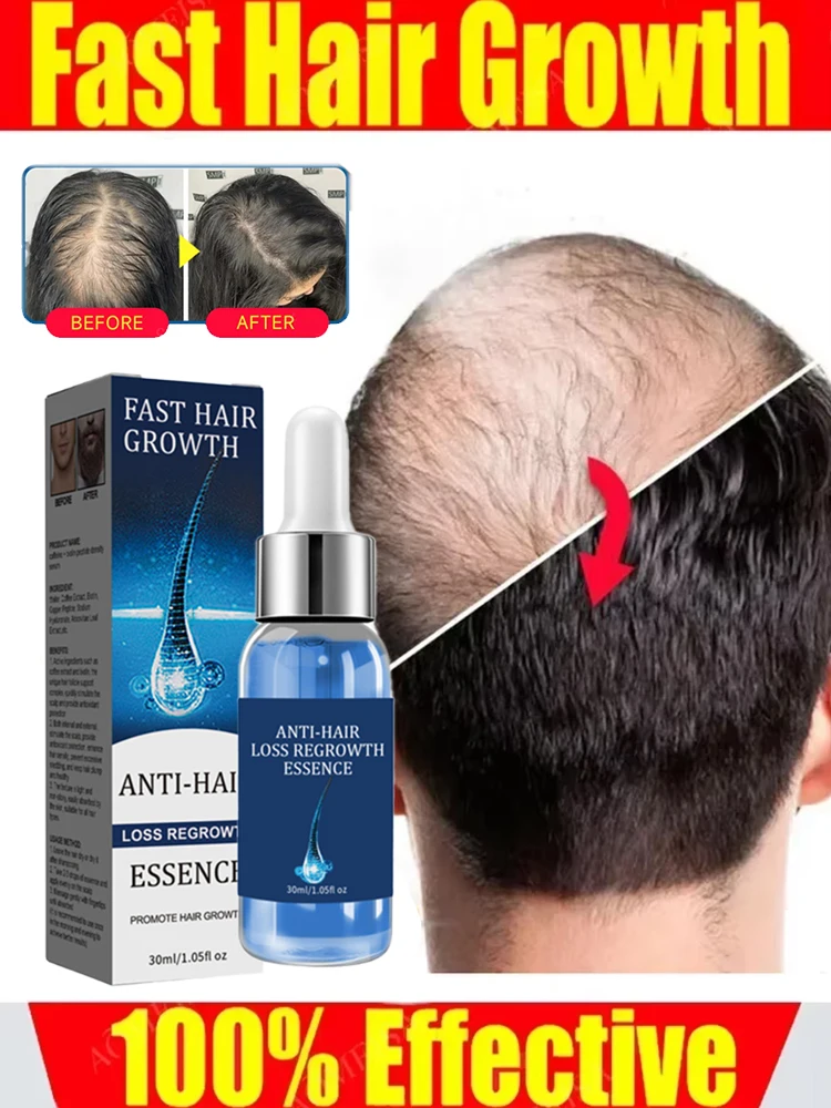 

Fast Hair Growth Oil Effective Baldness Repair Hereditary Hair Loss Postpartum Hair Loss Seborrheic