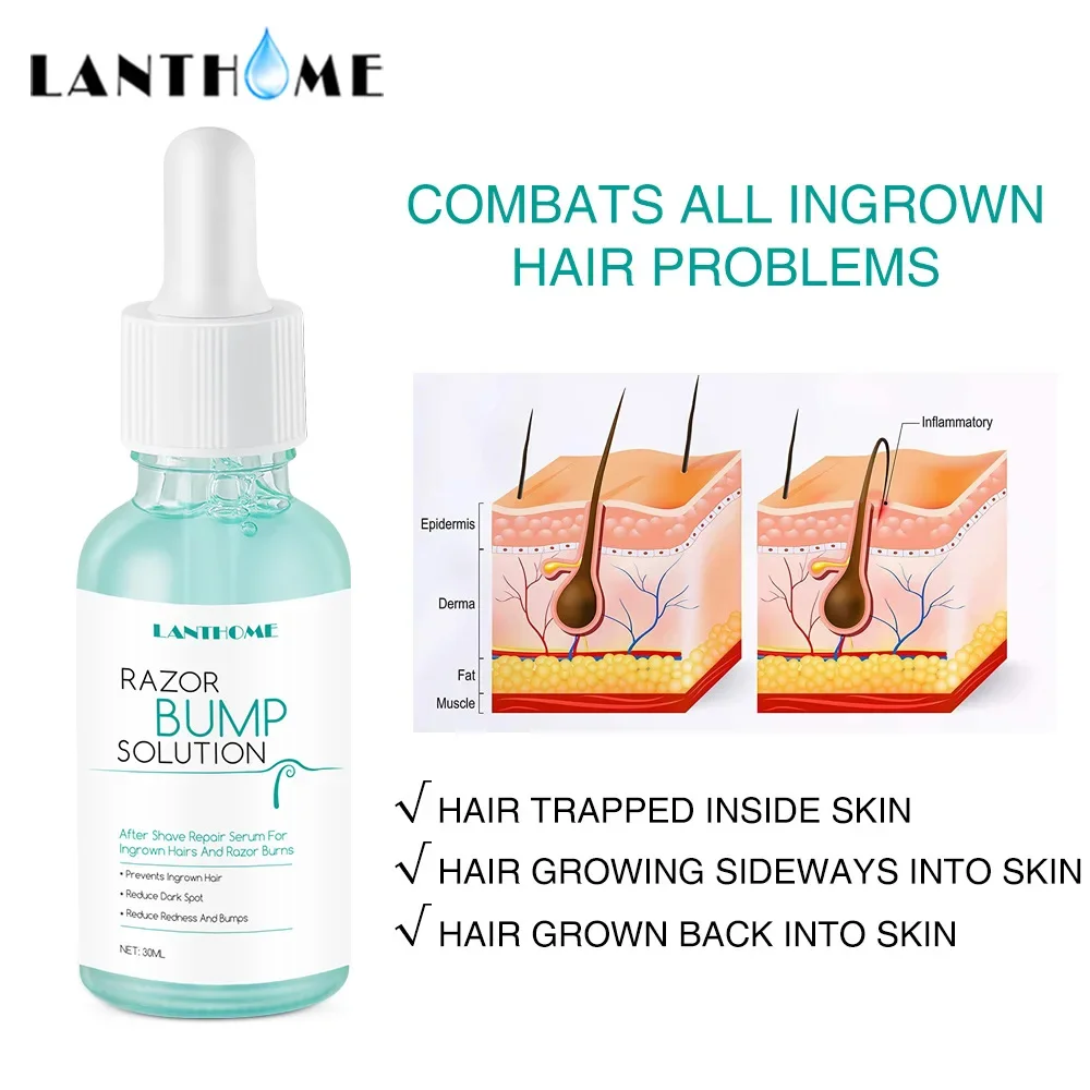 Prevent Growth in Hair Essence  Ingrown Smoothes Skin Treats Prevents Razor Bump Reduce Dark Spots Improve Skin Appearance