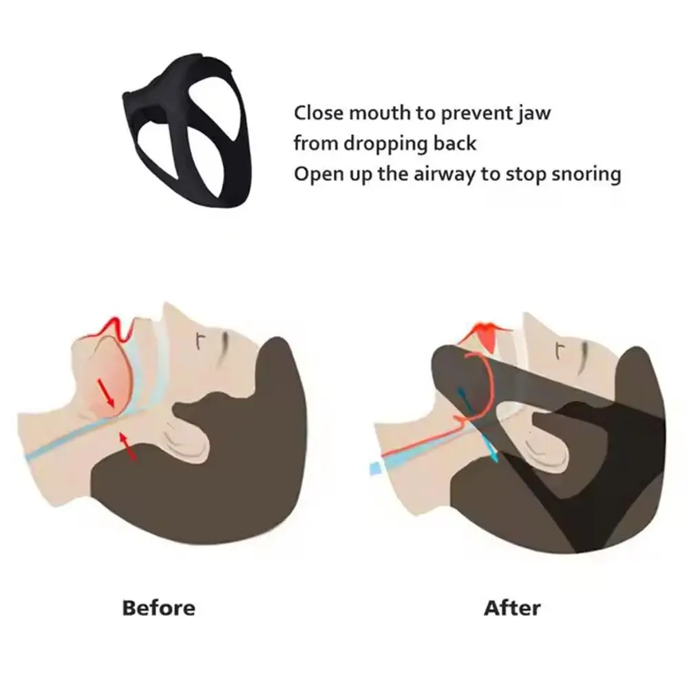 Anti Snore Belt Stop Snoring Chin Strap Woman Man Night Sleeping Support Aid Tools Snoring Protection Jaw Bandage Health Care