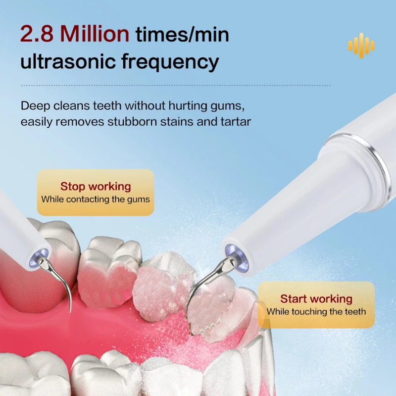 Xiaomi Youpin Ultrasonic Dental Scaler 2.8M/min High Frequency Vibrating Teeth Cleaner Plaque Calculus Tartar Stains Remover