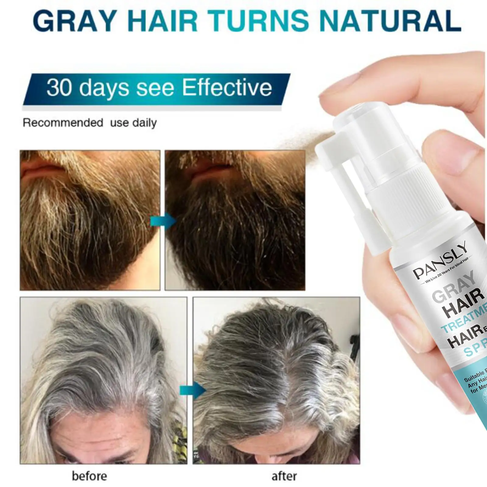 

Herbal Cure White Hair Treatment Spray Beard Hair Scalp Treatment