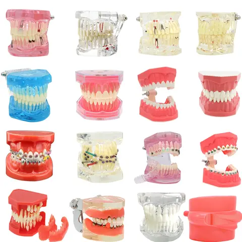Multiple Types Dental Teeth Model Teaching Models Typodont Orthodontic Model For Studying Dentistry Products Demo