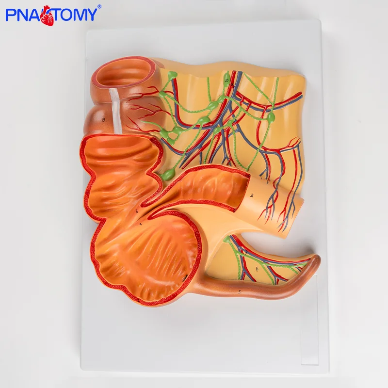 

Human Anatomical Ileocecal Model Cecum Appendix Ascending Colon Ileum Vessels Appendix Model