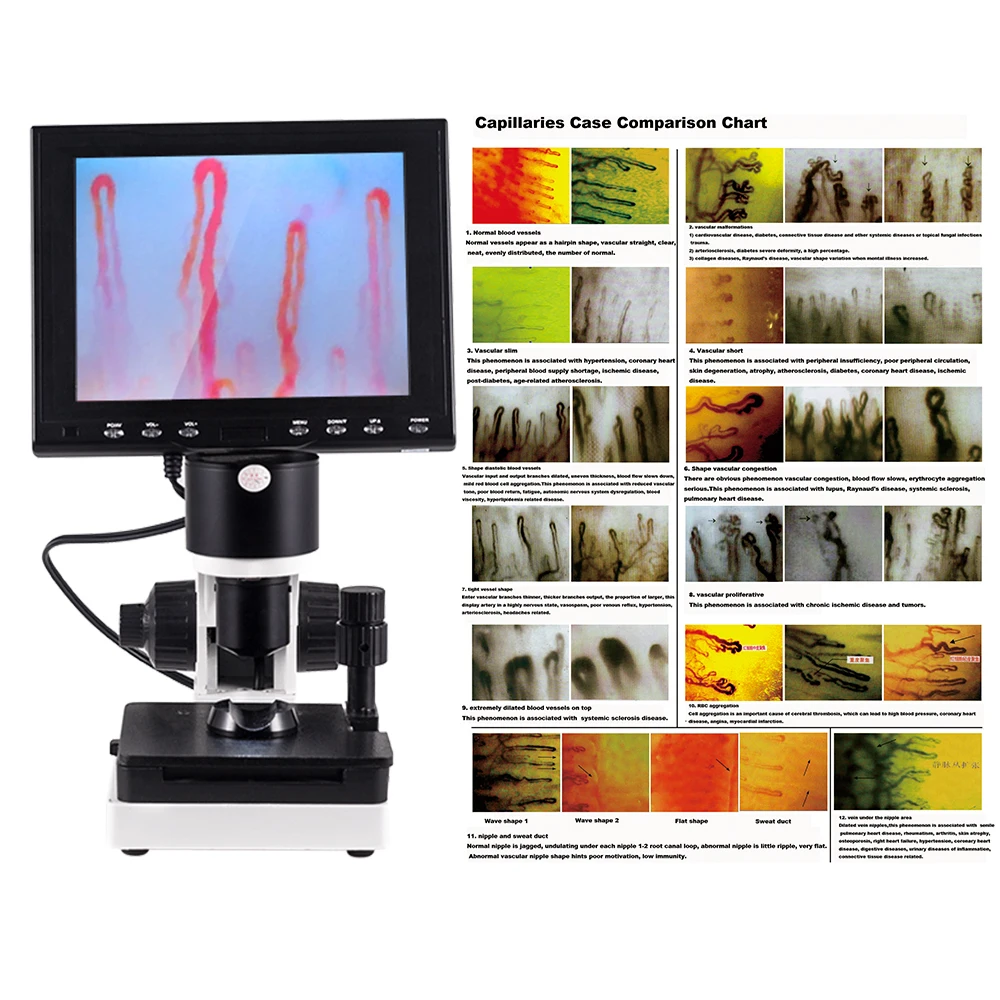 Biological Nail Fold Blood Test Digital Microcirculation Microscope Digital Capillary Microscope