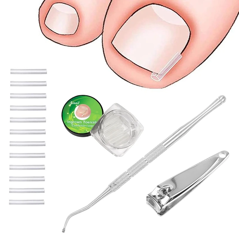 Ingrown Toenail Lifter Corrector Liner Stainless Steel Ingrown Toenail Tool Cleaner Dropship