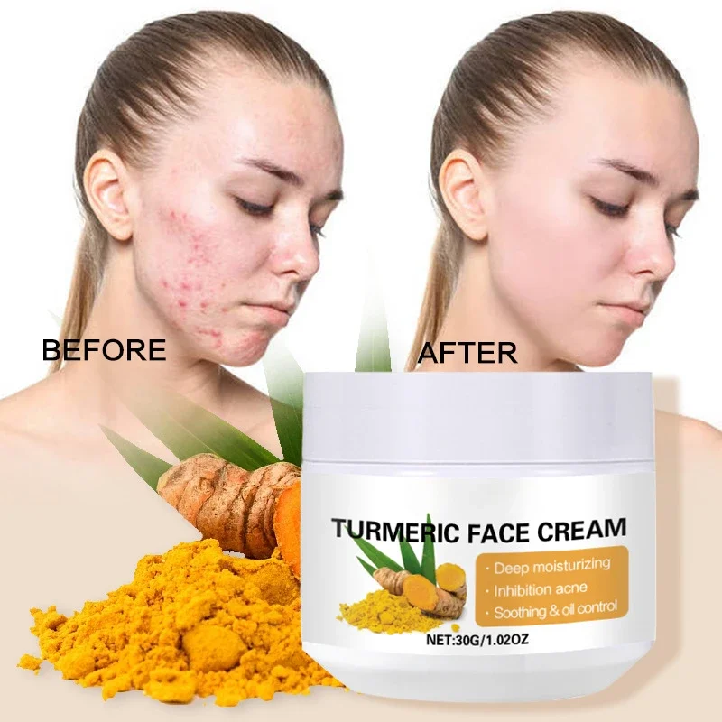 30g Turmeric Face Cream Repair  Skin Luster Resist Oxidation Inhibit Melanin Brighten Skin Tone Diminish Inflammation