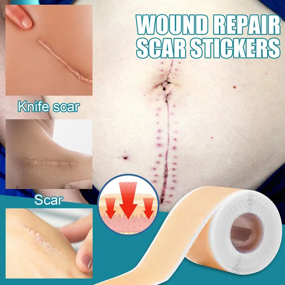 1/2pcs Silicone Gel Scar Sheet Patch Treatment Removal Tape Acne Trauma Burn Scar Cover Skin Repair Section Ear Beauty Skin Care