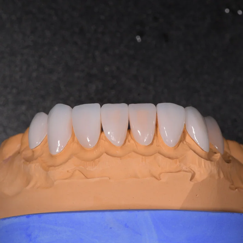 Zirconia Blocks SHTML หลายชั้น 98 มม. ระบบเปิด Ceradirect สําหรับห้องปฏิบัติการทันตกรรม CAD/CAM