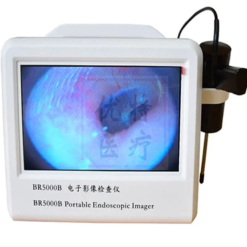 Human nasal  ear canal endoscope, visual  nasal , electronic  pet animal otoscope