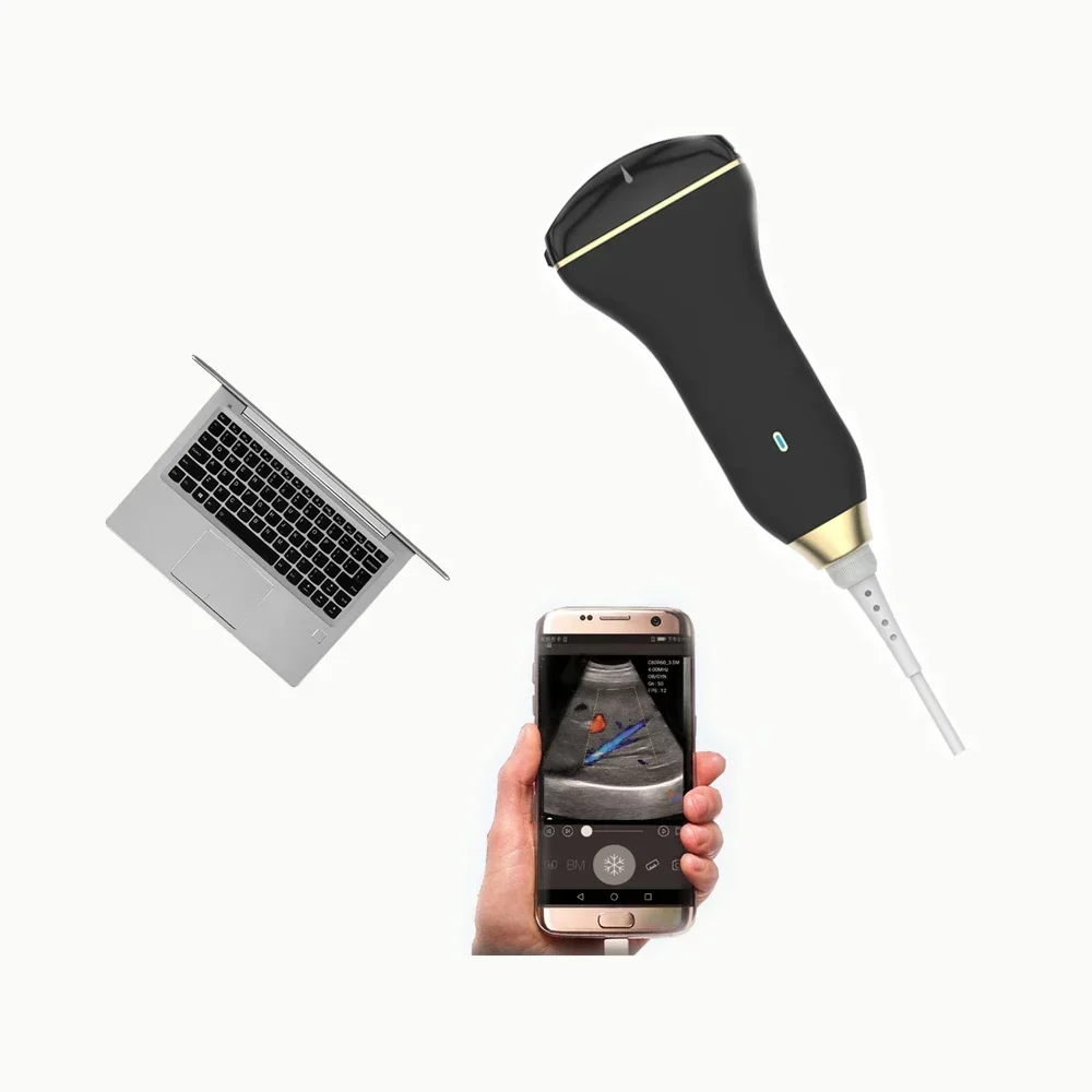 Pemindai Ultrasound Doppler Warna Gema USB Mini Tipe C Android Windows Probe Linier Cembung