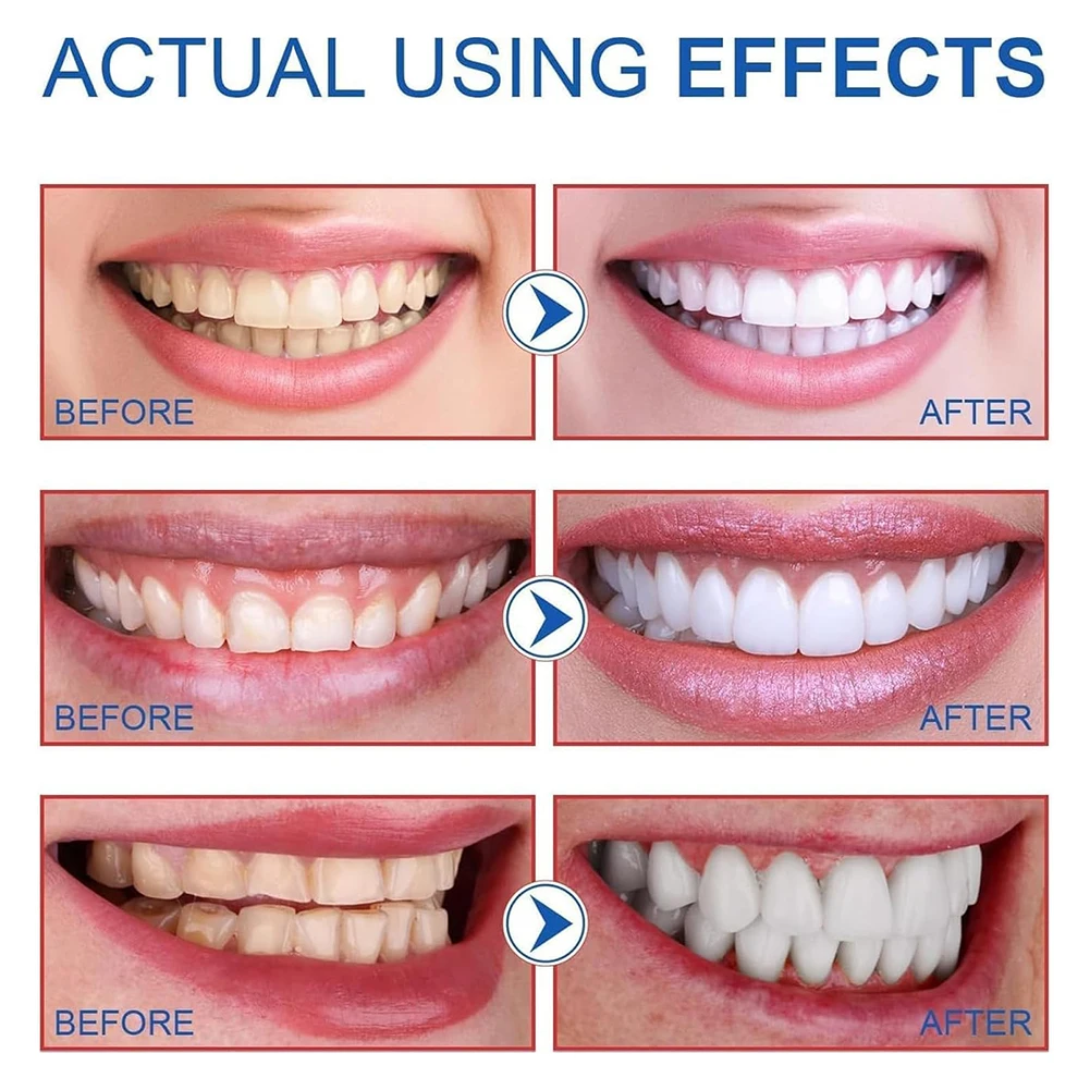 SP6 Probiotics Whitening Toothpaste Fresh Breath Effective Keep Oral Hygiene Tooth Paste Oral Care Supplies For Women Men 140g