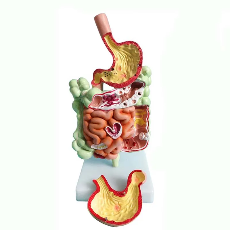 Modelo de anatomía del Sistema Quirúrgico humano, herramientas de enseñanza médica, envío directo