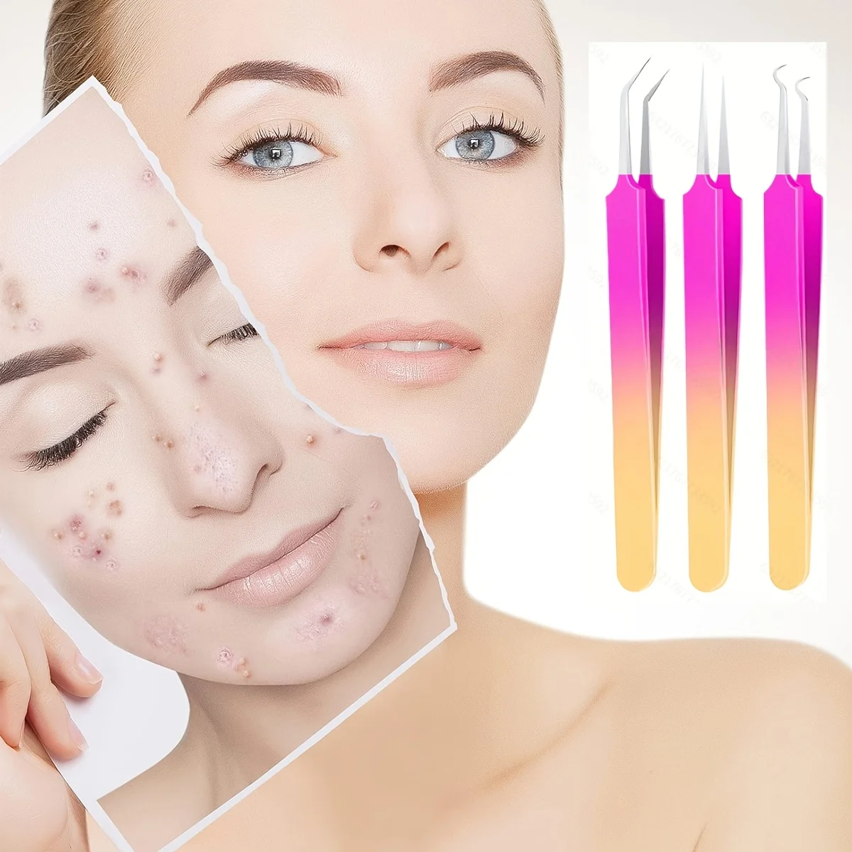7-częściowy profesjonalny zestaw narzędzi do usuwania zaskórników ze stali nierdzewnej - zestaw do usuwania zaskórników z pęsetami, klipsem do komórek i ekstraktorem do twarzy