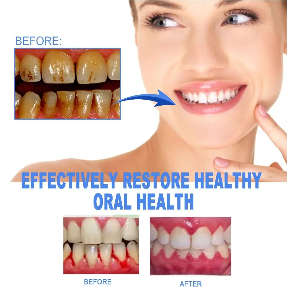 Oral Care Gum Treatment Gel Dental Repair Reduces Inflammation Gum Shield Therapy Gel Easy to Use Reduces Discomfort