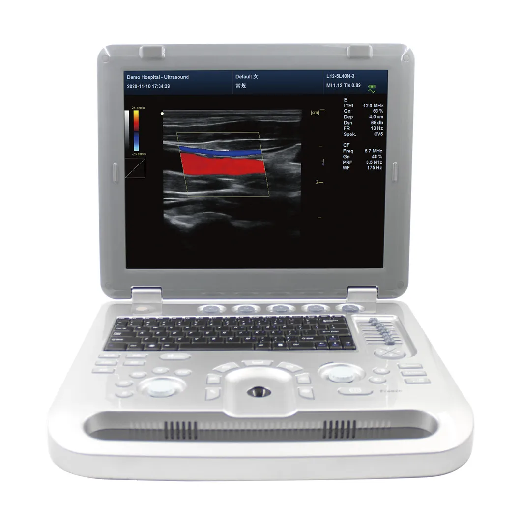 Full digital color portable cardiac obstetrics gynecology small organs urology ULTRASOUND SCANNER