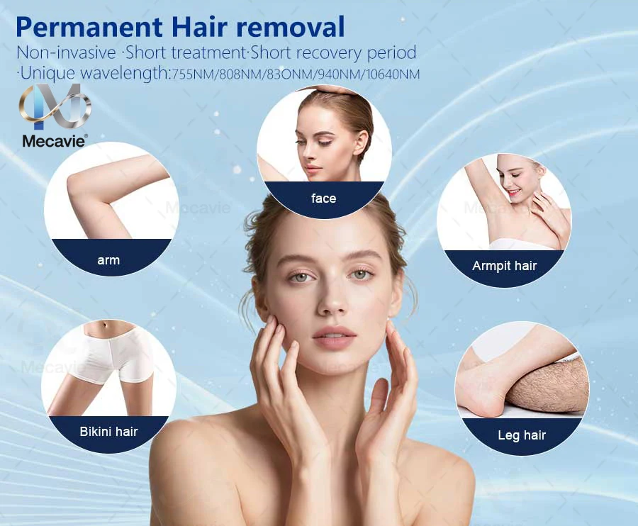 2026 Professional 5000W Four-Wave Diode Laser Hair Removal Device Suitable for Beauty Salons