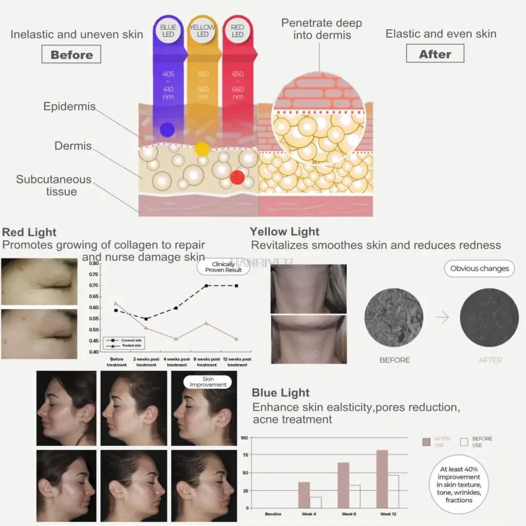 2025-gran-oferta-led-masker-huidverjonging-gezichtsverzorging-gezicht-aanscherping-lichttherapie-masker-antienvejecimiento-anti-encaranamiento