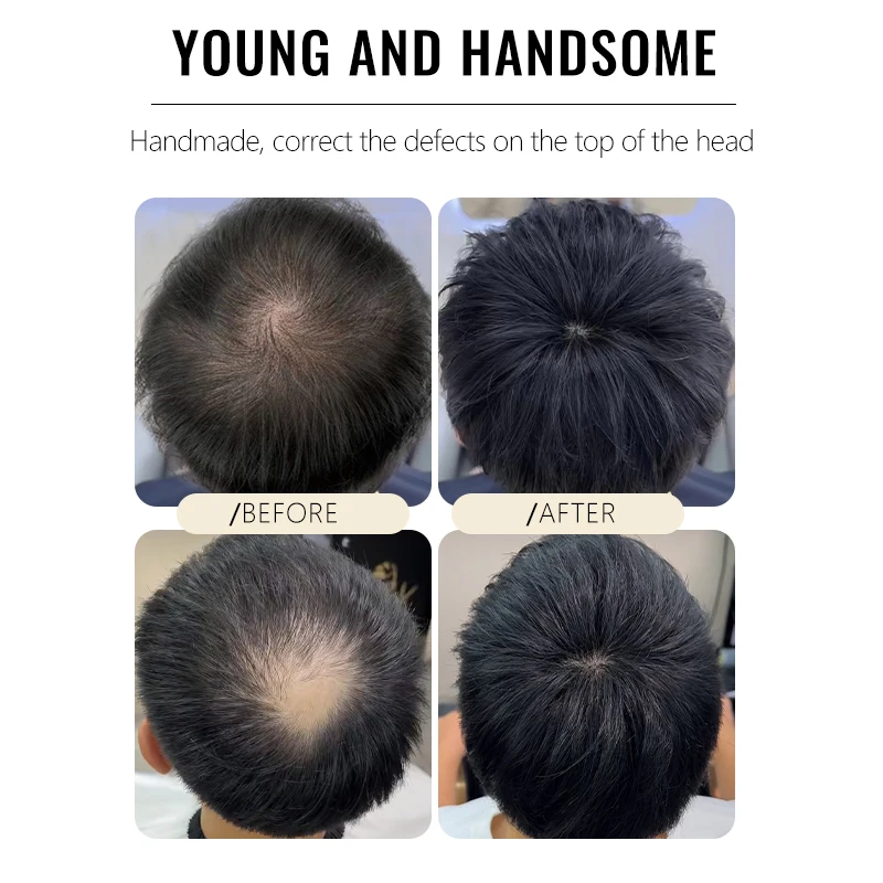 Mens Human Hair Natural Breathable Thinning Hair Cover-Up Top of The Head Balding Concealment Toupee Lace Pieces Wigs
